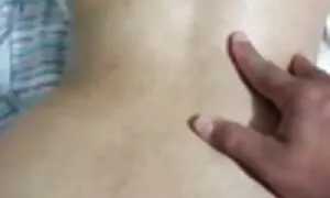 في زوجة هبوط الشرج،  ...