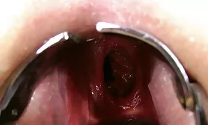 مشعرات الشرج مزدوجة، ...